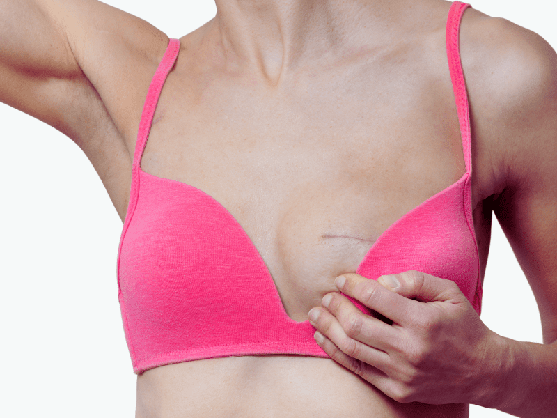Breast Augmentation in Dubai | Breast Implants in Dubai – Dr Faisal Salim