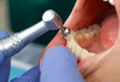 Dental Clinic in Dubai