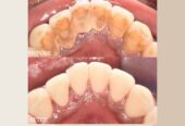 Dental Clinic in Dubai