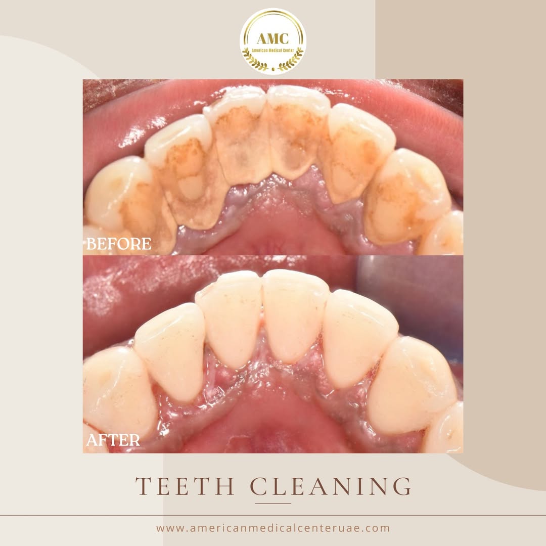 Dental Clinic in Dubai